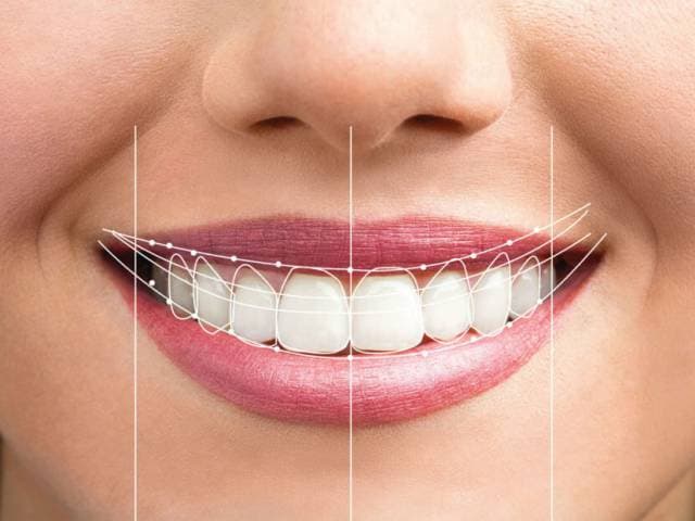 Smile Design & Zahnkronen