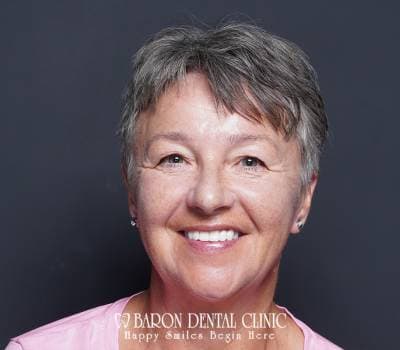 Baron Dental Patient 32