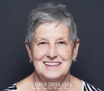 Baron Dental Patient 33