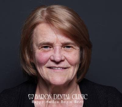 Baron Dental Patient 34