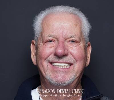 Baron Dental Patient 9