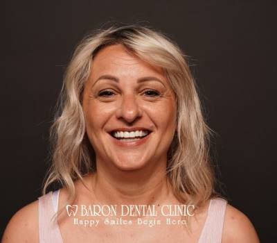 Baron Dental Patient 3