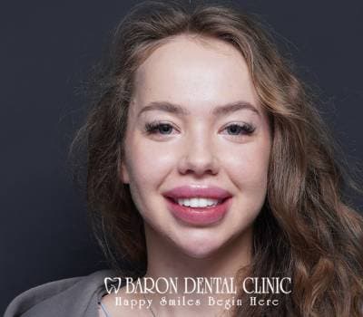 Baron Dental Patient 27