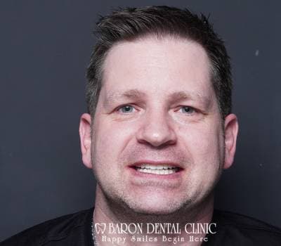 Baron Dental Patient 6