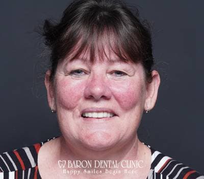 Baron Dental Patient 22