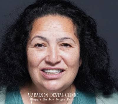 Baron Dental Patient 45