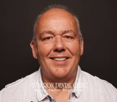 Baron Dental Patient 26