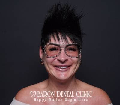 Baron Dental Patient 1