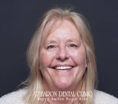 Baron Dental Patient 35