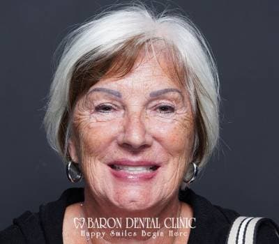 Baron Dental Patient 7