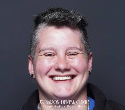 Baron Dental Patient 17