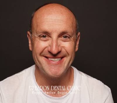 Baron Dental Patient 40