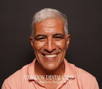 Baron Dental Patient 25