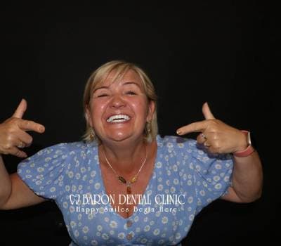 Baron Dental Patient 14