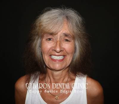 Baron Dental Patient 45