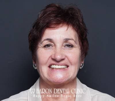 Baron Dental Patient 16