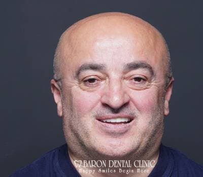 Baron Dental Patient 46