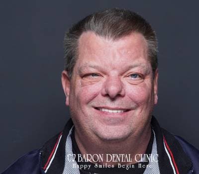 Baron Dental Patient 11