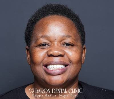 Baron Dental Patient 15