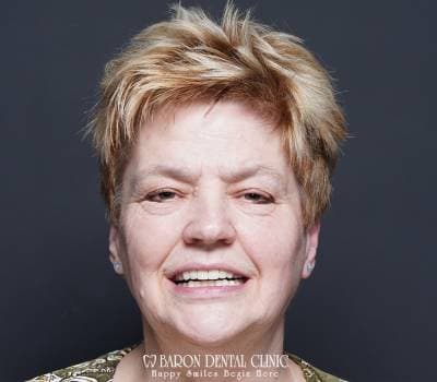 Baron Dental Patient 23