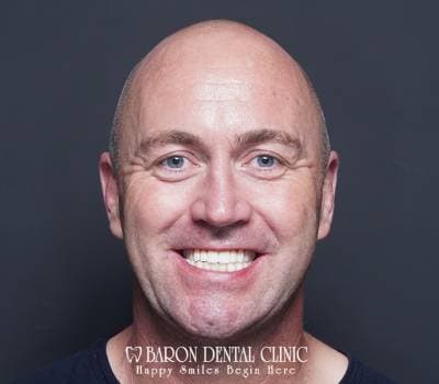 Baron Dental Patient 48