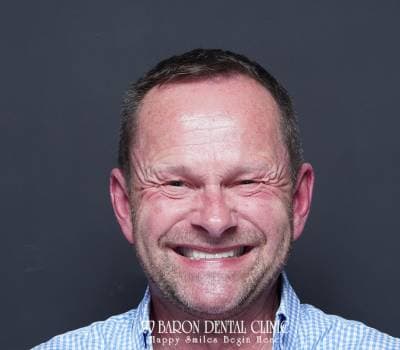 Baron Dental Patient 19