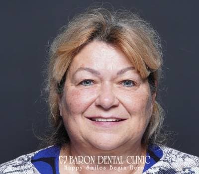 Baron Dental Patient 37