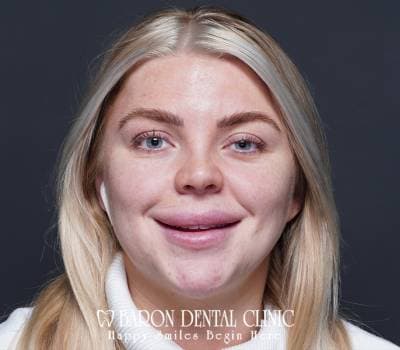 Baron Dental Patient 38