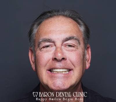 Baron Dental Patient 1