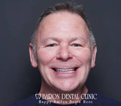 Baron Dental Patient 28
