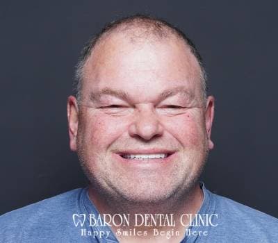 Baron Dental Patient 36
