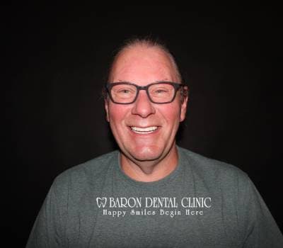 Baron Dental Patient 48