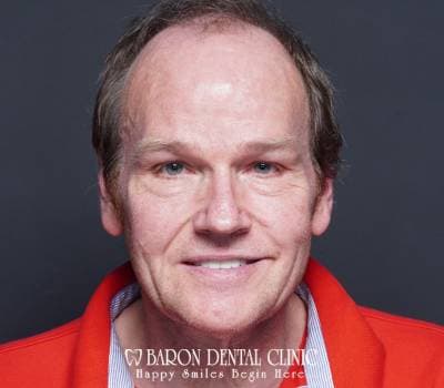 Baron Dental Patient 30