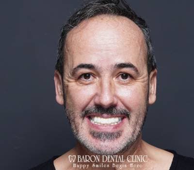 Baron Dental Patient 26