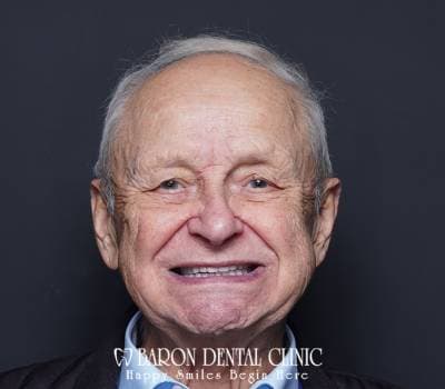 Baron Dental Patient 29