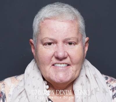 Baron Dental Patient 2
