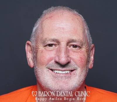 Baron Dental Patient 30