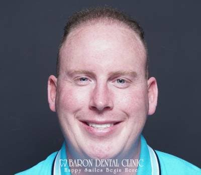 Baron Dental Patient 44