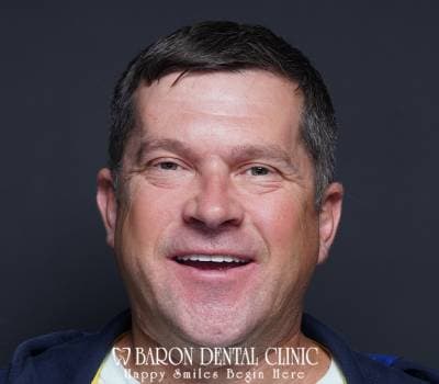Baron Dental Patient 31