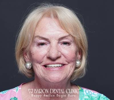 Baron Dental Patient 43
