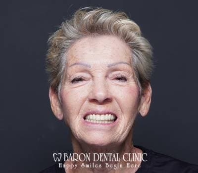 Baron Dental Patient 3