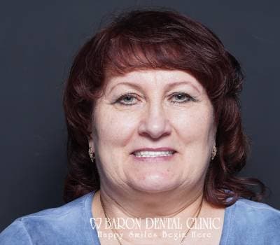 Baron Dental Patient 39