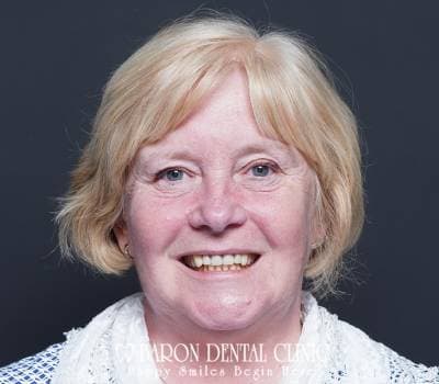 Baron Dental Patient 50