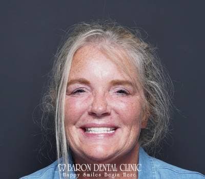 Baron Dental Patient 8