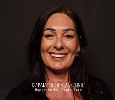 Baron Dental Patient 4