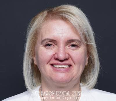 Baron Dental Patient 33