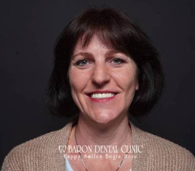 Baron Dental Patient 8