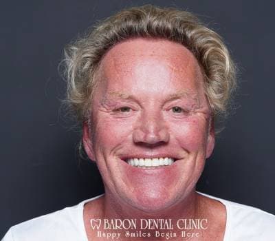 Baron Dental Patient 31