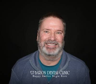 Baron Dental Patient 38