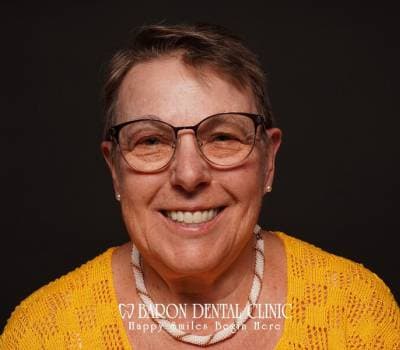 Baron Dental Patient 18